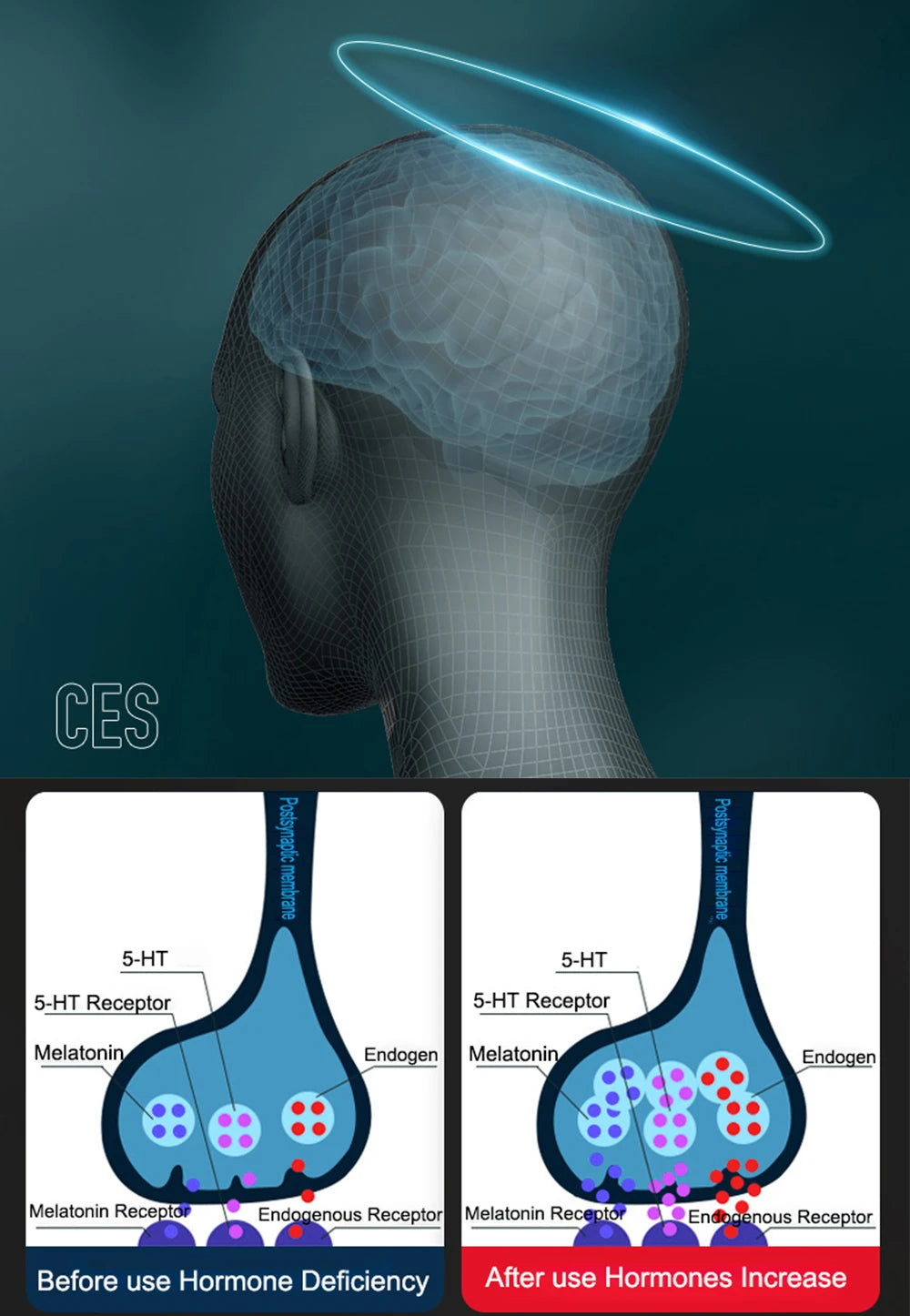 CES improves melatonin receptors and endogen receptor, improving sleep.