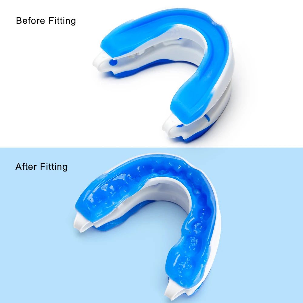 Before and after fitting the mouth gard.