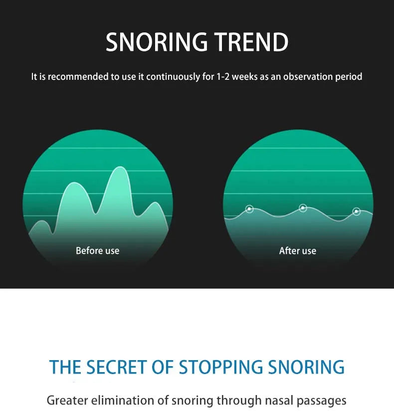 Diagram showing before and after using the anti-snoring device, the snore trend dropped drastically.
