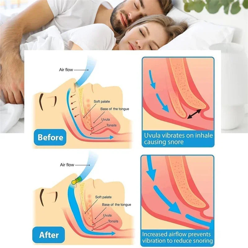 The anti snoring sleep apnea magnetic clip prevents the uvula vibratiion during snoring. Air flow is better after using.