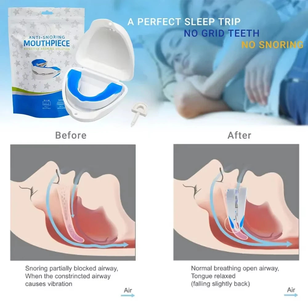 Anti snoring mouth gard also prevents teeth grinding and diagram shows open airways during sleep.