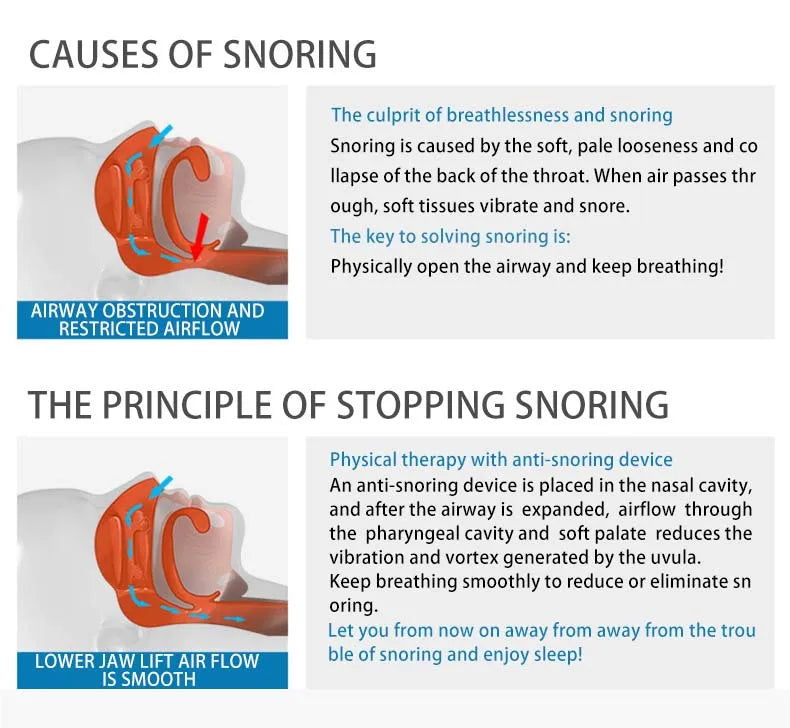 Diagram explaining causes of snoring and how using the anti snoring device will help.