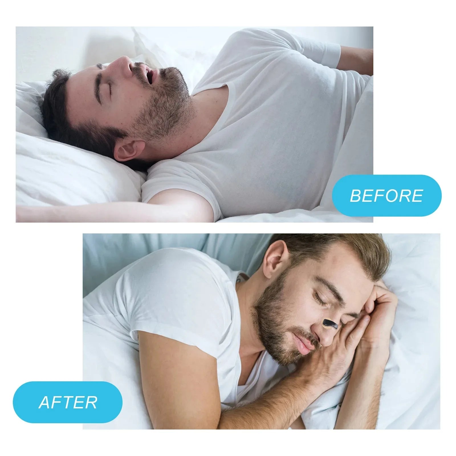 Picture showing before and after effect of using the nasal dilator which helps to sooth nasal passage prevents snores.