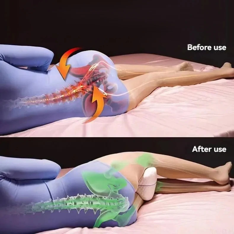 Before and after use comparison of the leg pillow on a person's leg.