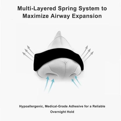 Diagram of a multi-layered spring system for airway expansion with text about adhesive quality.